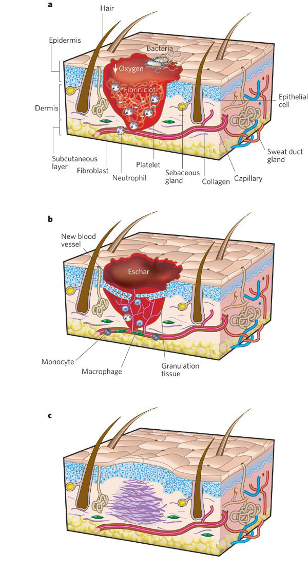 fases cicatrización